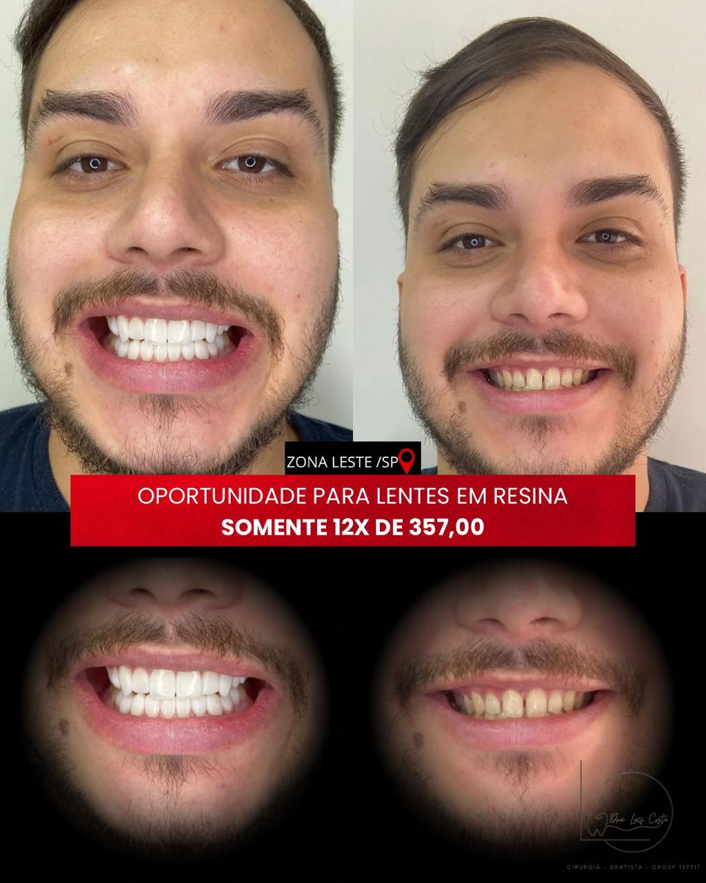 Resultado 1